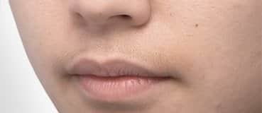 epilator Flawless